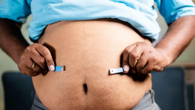 लठ्ठपणा, आरोग्य, 