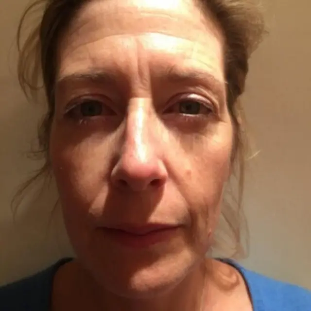 विकी बोर्न