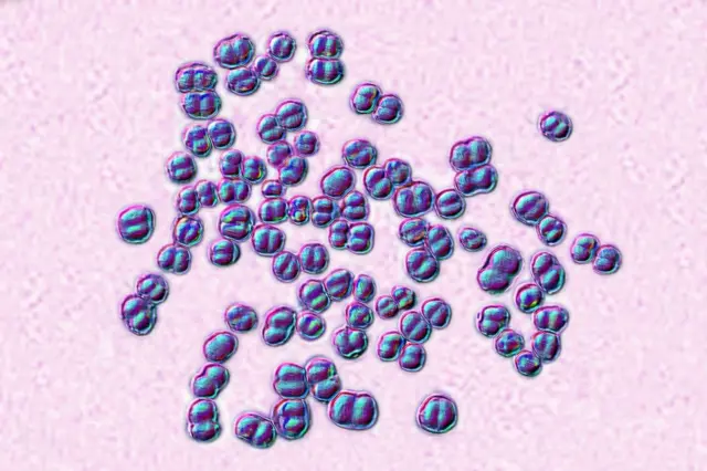 Neisseria meningitidis bakterisinin mikroskop altındaki görüntüsü