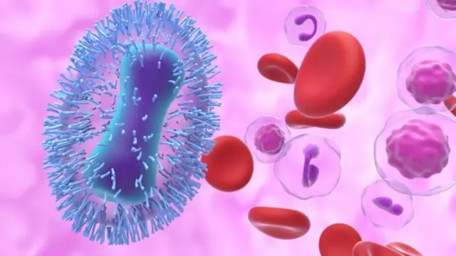 ਐੱਮ ਪੌਕਸ