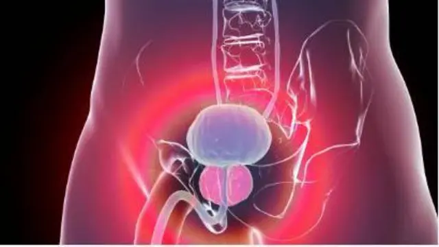 বয়স্ক পুরুষদের প্রোস্টেট ক্যান্সার বেশি হয় 