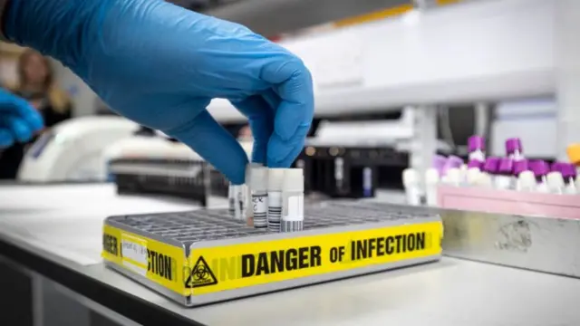 Пробирки с образцами коронавируса в лаборатории