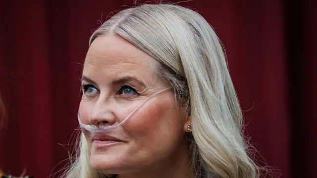 Un primer plano de Mette-Marit con un tubo de respiración conectado a un dispositivo de oxígeno.