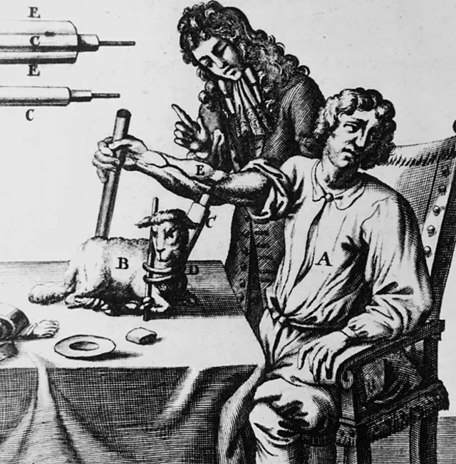 El fisiólogo inglés Richard Lower (1631-1691) transfundiendo sangre de un cordero al brazo de un hombre en 1667.