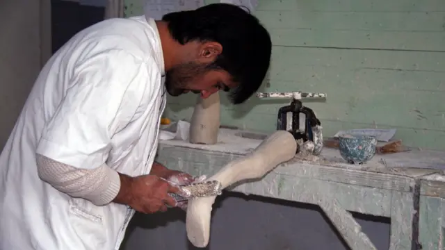 خدمات رایگان کارخانه اورتز و پروتز شهر دوشنبه