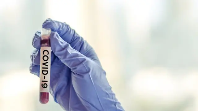 கொரோனா தாக்கம்: தேனியில் வருகிறது புதிய பரிசோதனை கூடம்