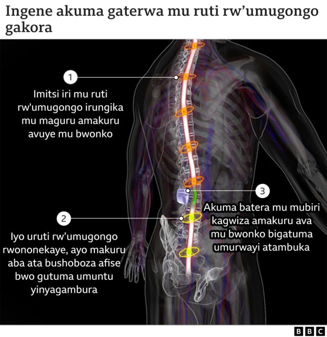 Ingene akuma bashira mu ruti rw'umugongo gakora