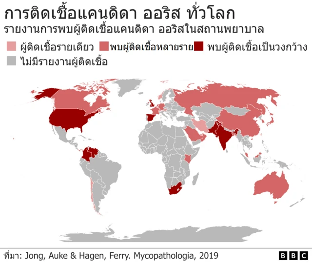 การติดเชื้อแคนดิดา ออริส ทั่วโลก