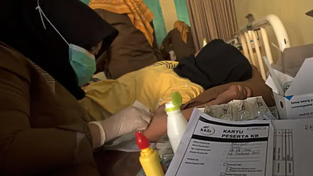Pemasangan KB pada perempuan