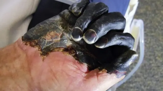 ብጸሊም ሞት ዝተለኽፈ ሰብ