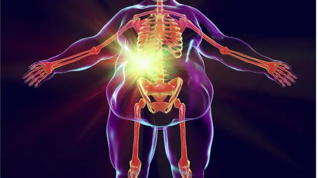 স্থুলতা