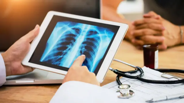 Médecin montrant les résultats d'une radiographie à un patient 