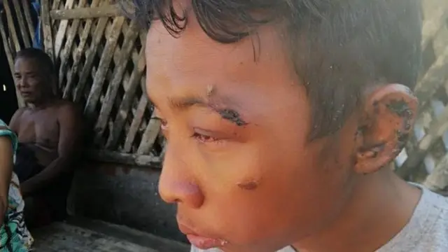 ဒဂုံတက္ကသိုလ်နောက်ဆုံးနှစ်ကျောင်းသားကို ငွေခုနစ်သိန်းနဲ့ ရန်ကုန်ကနေ ဖျာပုံထဲက ငါးဒိုင်တစ်ခုမှာ ရောင်းစားသွားတာဖြစ်ပါတယ်။