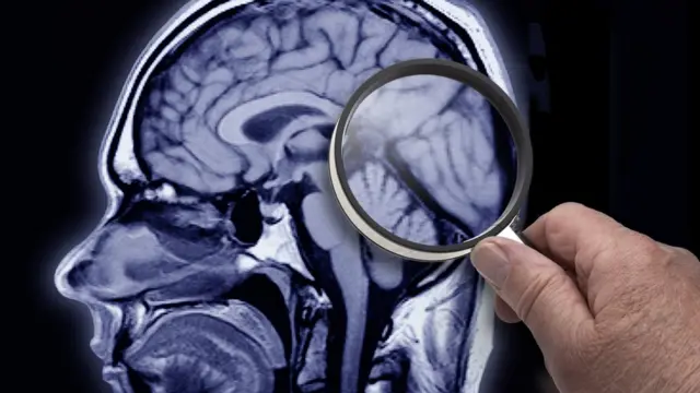 cerebro