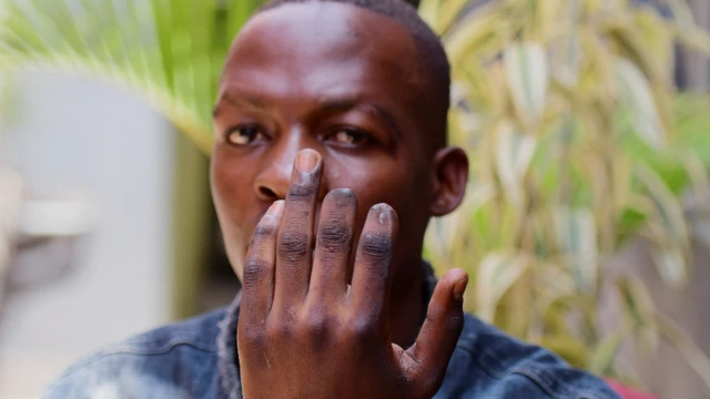 Ronald Ssegawa, 22, akionyesha vidole viwili alivyopoteza sehemu yake baada ya kuteswa huko Kampala, Uganda - Jumatatu 21 Machi 2022