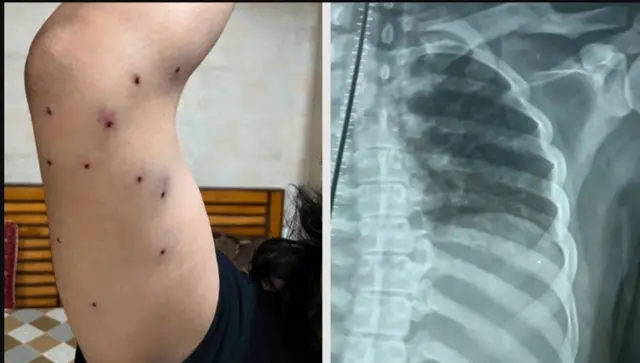 नाव न सांगण्याच्या अटीवर 28 वर्षीय पत्रकाराने आपल्यासोबत काय घडले याची माहिती बीबीसीला दिली.