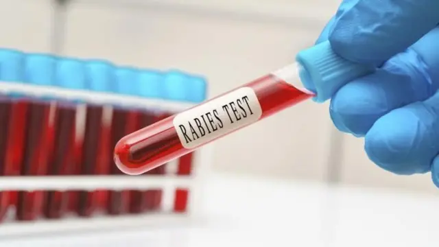 रेबीजमुळे एका महिलेचा मृत्यू झाल्यानंतर लसीकरणाबद्दल सल्ला घेणाऱ्या प्रवाशांच्या संख्येत वाढ झाली असल्याचं एका फार्मासिस्टनं म्हटलं आहे.