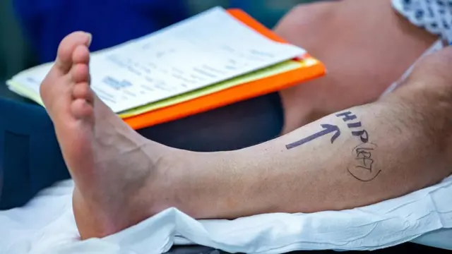 Les erreurs commises lors de procédures médicales en raison d'erreurs gauche-droite ont conduit certains chirurgiens à prendre des mesures supplémentaires pour s'assurer qu'ils opèrent au bon endroit