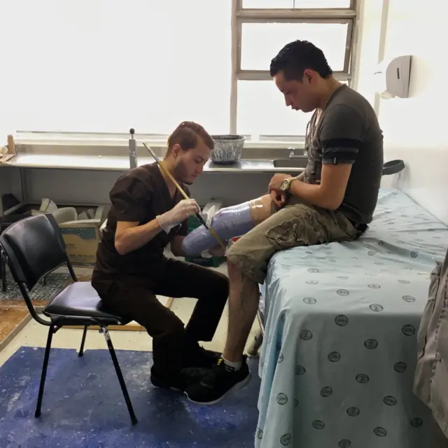 Experto fabrica una prótesis a un soldado que perdió la pierna derecha