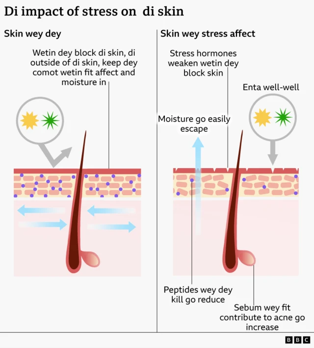 Graphic wey show di difference between healthy skin and skin wey dey affected by stress. For skin wey dey affected by stress, di outer barrier of di skin get small breaks, and di brick-like structure of di cells under am dey disordered, dey allow moisture to escape and irritants to enter more easily.