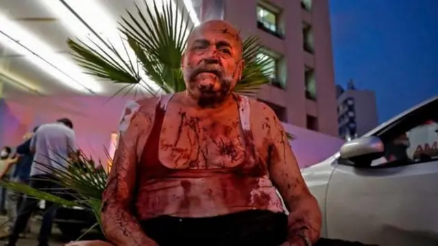 Ledakan hebat di Beirut