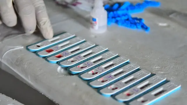 హెచ్ఐవీ, వ్యాక్సిన్