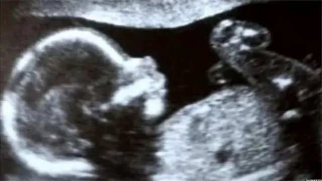 प्रतीकात्मक फोटो