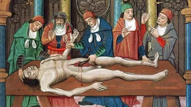 Өлүктү союу, XV кылымдагы француз трактатынан алынган сүрөт.