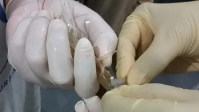 රෝග පරීක්ෂා සඳහා සාම්පල ලබා ගැනීම