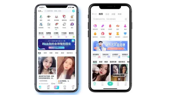 Applications de chirurgie esthétique en Chine