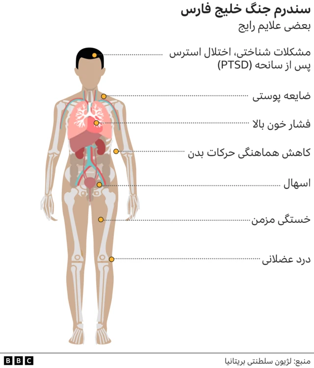 سندرم جنگ خلیج فارس، سال ۱۹۹۱