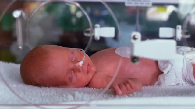 Немовля інкубаторі