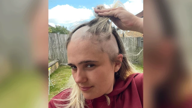 Phoebe Tesoriere no jardim, mostrando a queda do seu cabelo