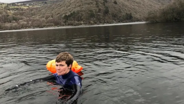 Covid de larga duración