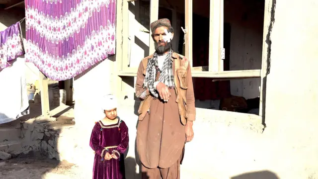 چهار نفر به شمول فریدون، پسر ۱۰ ساله، دختر ۶ ساله و همسر برادرش در حمله هوایی پاکستان به پلچرخی کابل زخمی شدهاند. فریدون که دست و صورتش زخمی شده و با بانداژ بسته است در کنار دختر ۶ سالهاش و در مقابل خانه ویرانش ایستاده است.