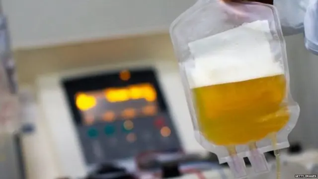 ਪਲਾਜ਼ਮਾ