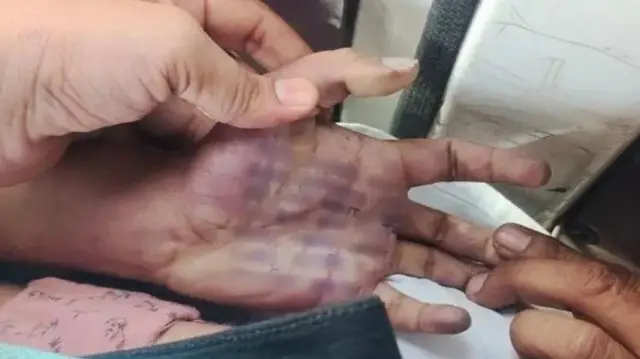 हाथ पर लिखे सुसाइ़ड नोट की तस्वीर