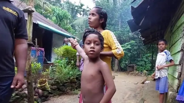 ஊட்டச்சத்துக் குறைபாடு