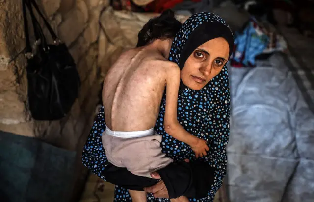 Islam Hajjaj ôm con gái 6 tuổi Najwa bị suy dinh dưỡng tại một khu trú ẩn ở trung tâm thành phố Gaza, vào ngày 11/5/2025