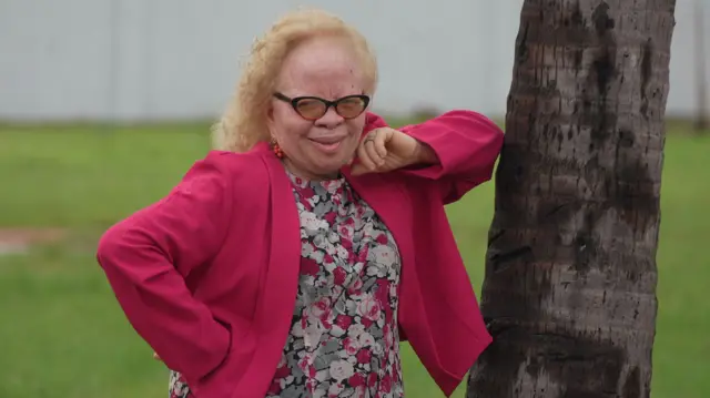 Dr Bisi Bamise, President National Albinism Association