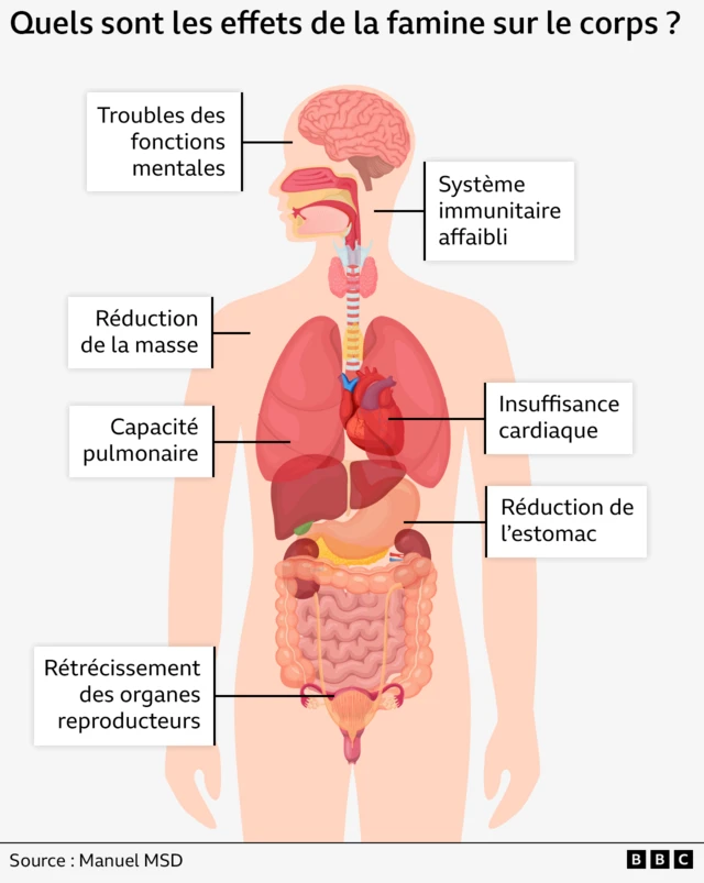 Les effets à long terme de la faim