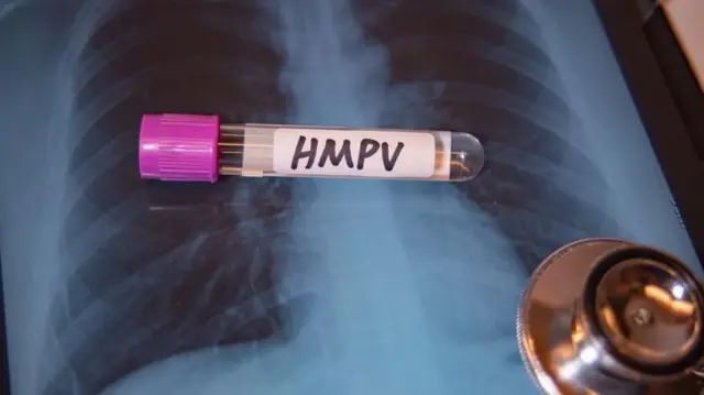 কোভিডের মতো নতুন কোনো ভাইরাস নয় এইচএমপিভি 