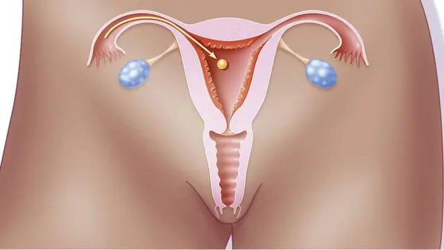 Etu nsọ nwaanyị si amalite