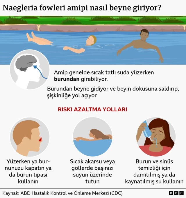 Görsel gazetecilik grafiği, Naegleria fowleri'nin beyne nasıl girdiğini gösteriyor.