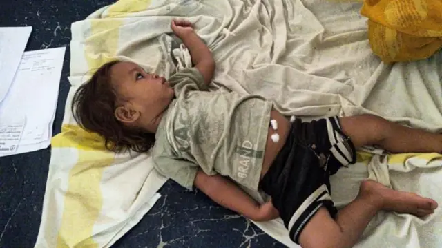 बाळ आता पूर्णपणे निरोगी आहे.