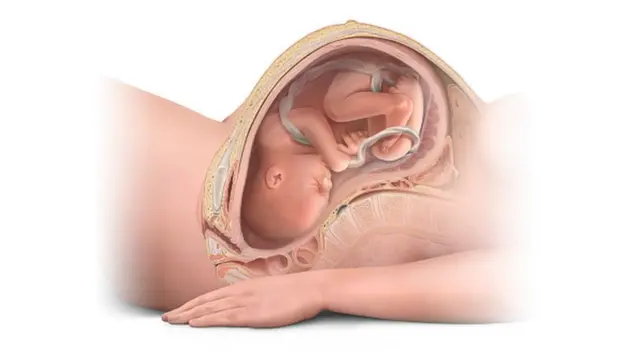 Ime afọ nwaanyị dị ime