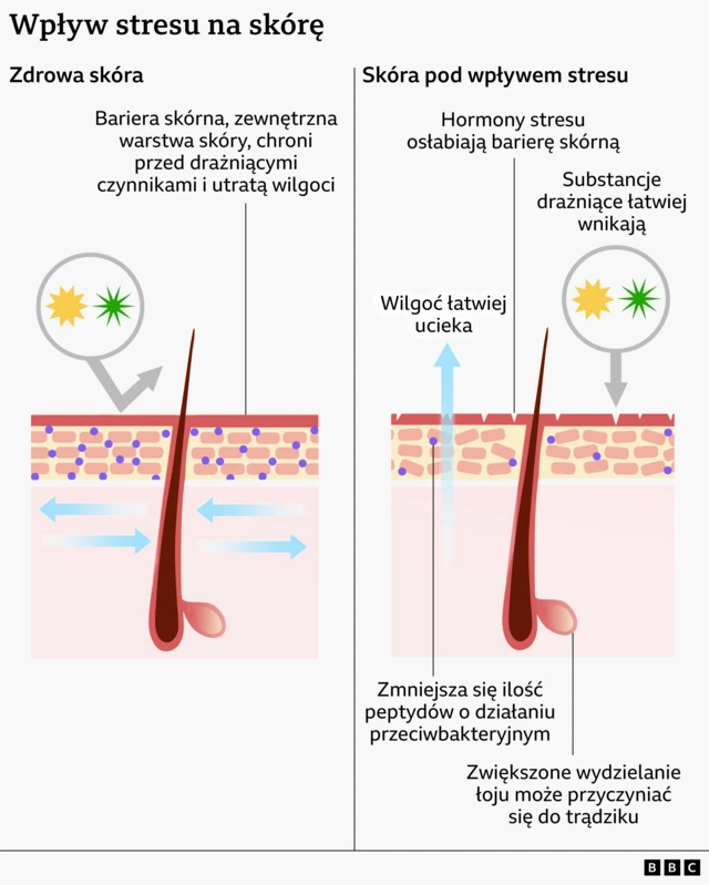 Grafika pokazuje różnicę między zdrową skórą, a skórą pod wpływem stresu. W tej drugiej warstwa ochronna ma drobne pęknięcia, a układ komórek pod nią jest zaburzony, co ułatwia utratę wilgoci i przenikanie substancji drażniących.