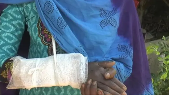 મહિલાને માર મારતાં કાંડામાં ફ્રેક્ચર થયું