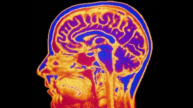 Una imagen de escáner de una cabeza