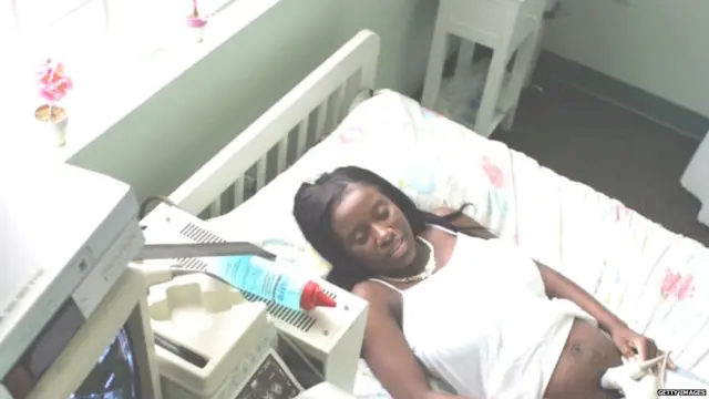 मिसकैरिज, गर्भपात, महिला